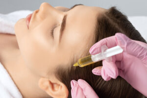 Cosmetologist does prp therapy against hair loss