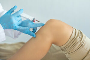 PRP Therapy for Knee Injury